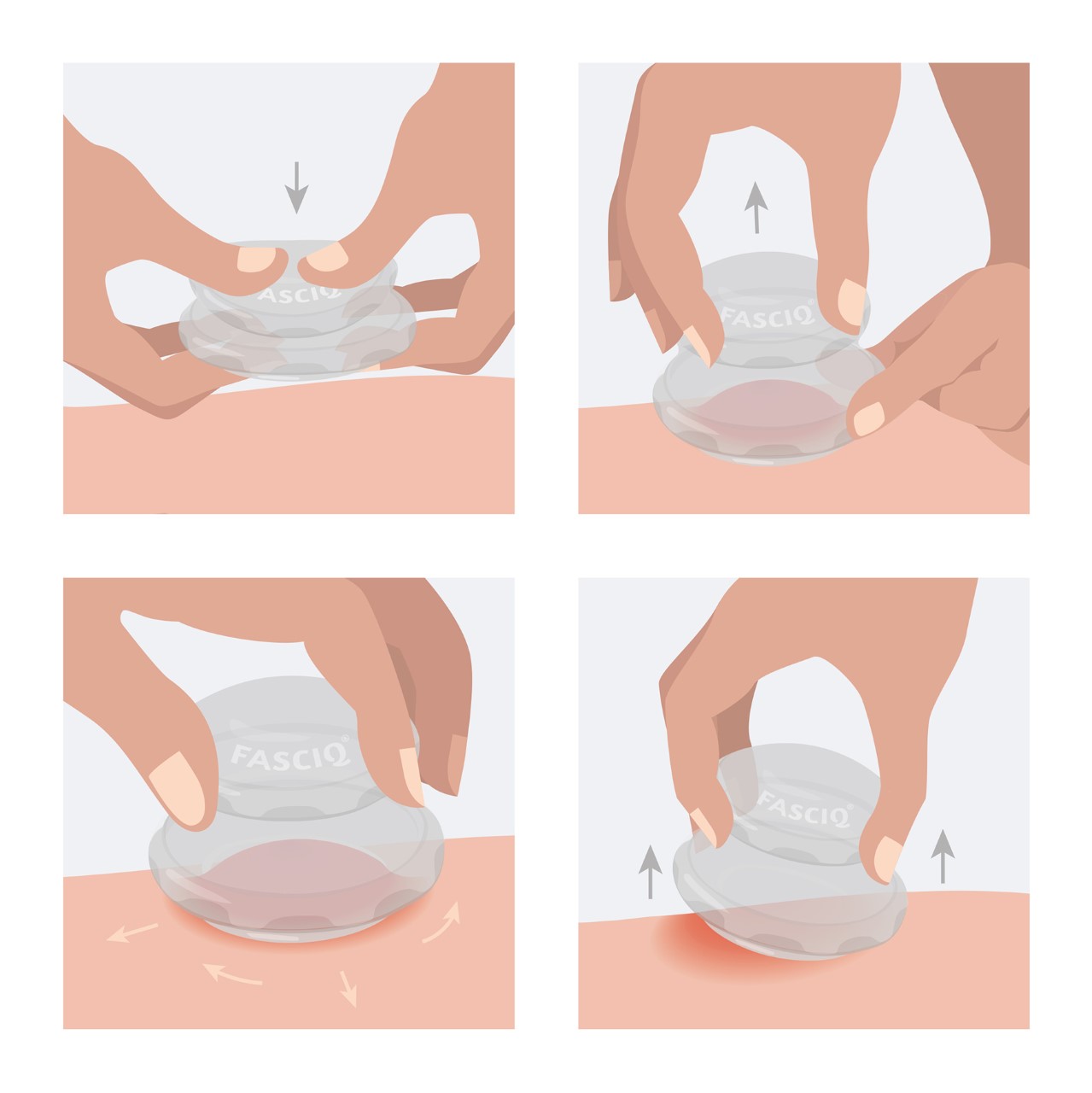 cellulite-cupping-set-thysol-australia